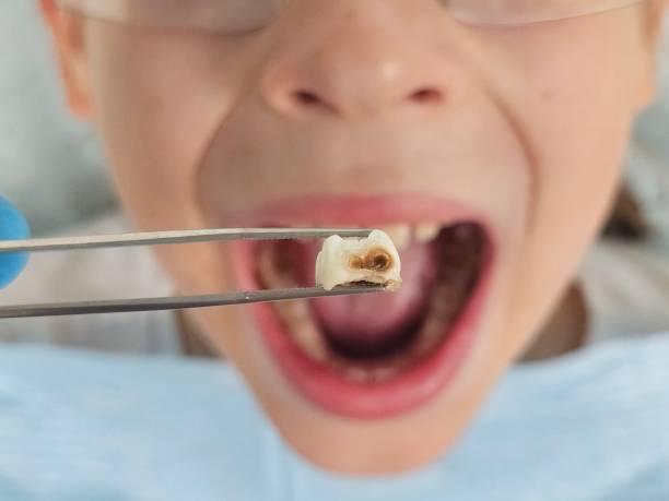 Best Pediatric Emergency Dentist in Walker, MI